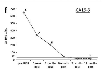 Tumor Marker Analysis After the Treatment